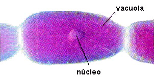 Célula coloreada por pigmentos antocianos