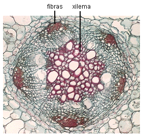 CTde raíz de soja mostrando ordenación de tejidos