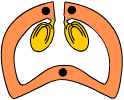Dehiscencia sutural simple  ventricida
