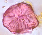 Braquiesclereida en pera