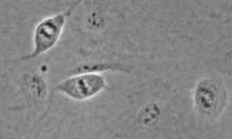 20X Phase-Contrast Image